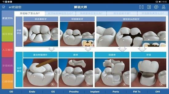 牙医解说大师 牙医解说大师