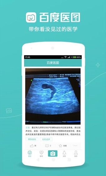 百度医图软件